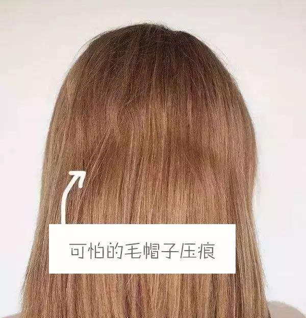 3招拯救秃头女孩,1招教你完美破防