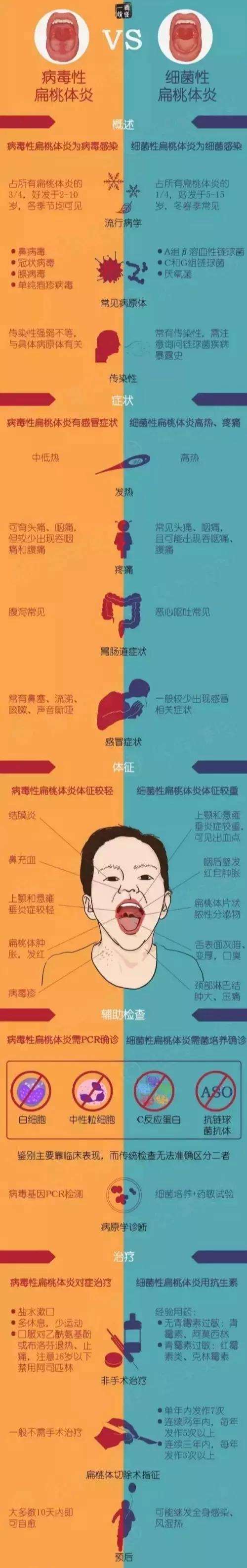 小孩扁桃体发炎看耳鼻喉还是儿科,医生看喉咙用的手电筒是什么光