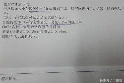 产后42天复查有没有必要？看看她们产后都“遭遇”了什么事……