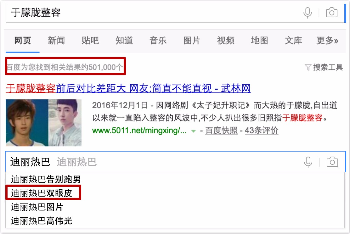 井柏然撞脸金城武，“僵硬”神器玻尿酸这次反而救了人？