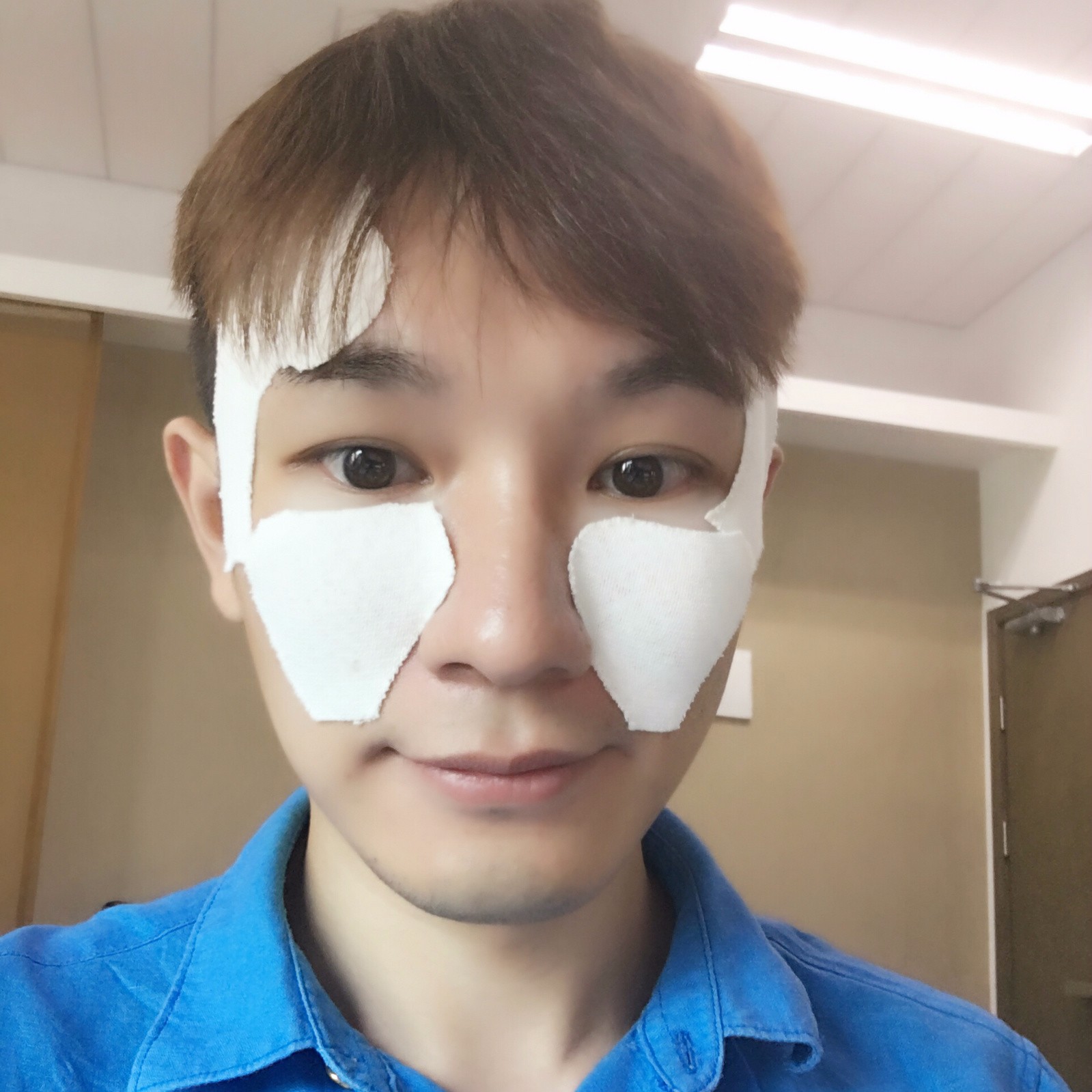 井柏然撞脸金城武，“僵硬”神器玻尿酸这次反而救了人？