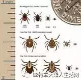 咬到嘴边肉和中风前兆有关系吗,舌头被牙齿咬到是脑中风的前兆吗