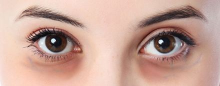 去眼周细纹最好眼霜,眼周干燥干纹用什么眼霜