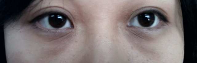 为什么眼周要用专门的眼霜,修正抗皱眼霜提亮眼周淡化黑眼圈