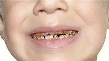 可乐怎样吃,可乐是怎么喝出来的