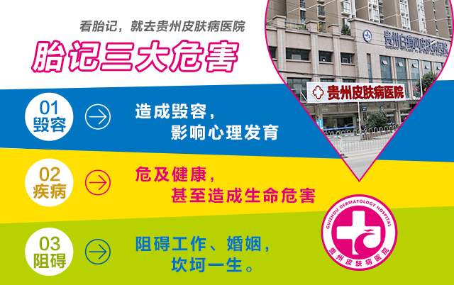 咖啡斑大讲堂，这些科普知识你不一定都知道