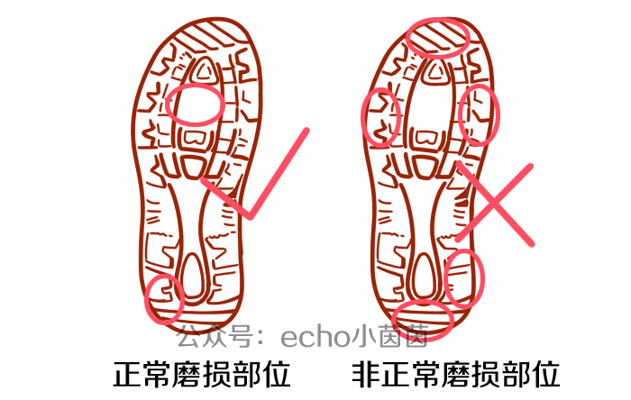 宝宝鞋底磨掉是什么原因,宝宝鞋底磨损滑怎么办教你一招