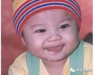 小儿流涎的饮食调理——20170508