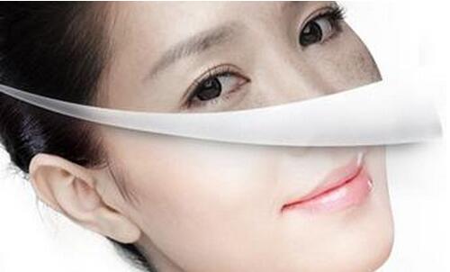 美版超声刀的副作用,做超声刀后有何副作用