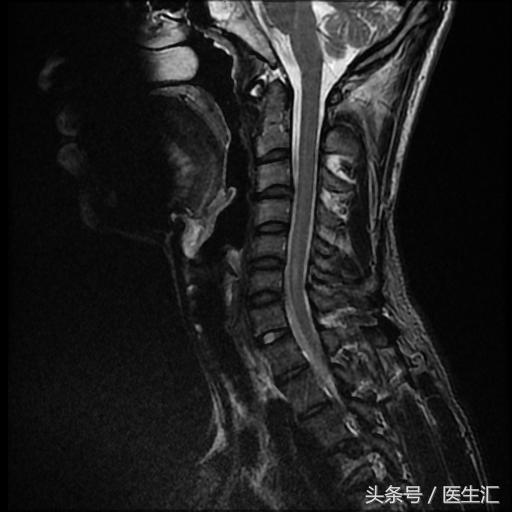 神经内科疾病诊断公式,神经系统疾病的诊断思路及步骤