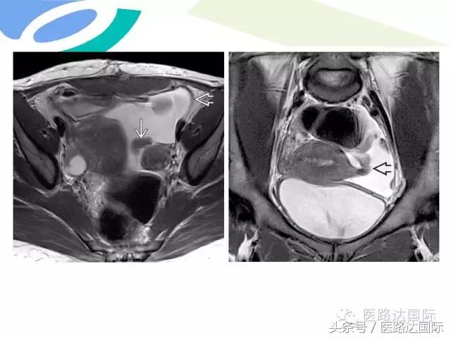 北京妇产医院梁宇霆,北京妇产医院梁宇霆出诊