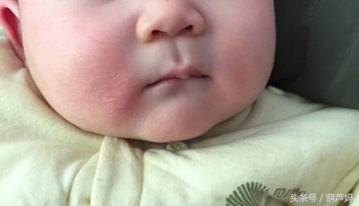 小宝宝鼻梁发青怎么回事,孩子鼻梁发青是吓到了吗