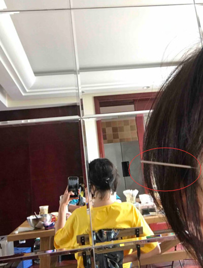 郑爽患病不敢去医院自己在家针灸,一句话透露她内心恐惧与不安!