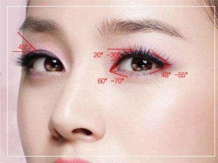 全切双眼皮增生不对称变丑,割完双眼皮为啥会变内双