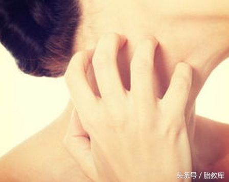 剖宫产手术20天刀口特别痒,剖宫产刀口痒怎么缓解