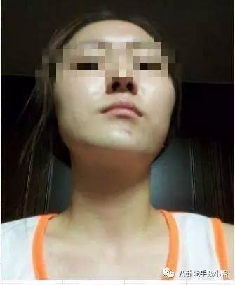 周冬雨鹿晗黄子韬的同款不对称下颌角，值得拥有吗？