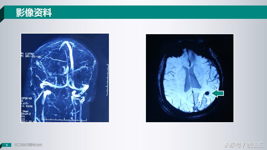 各项检查都正常为啥老是心慌,各项检查都正常为啥还是头晕