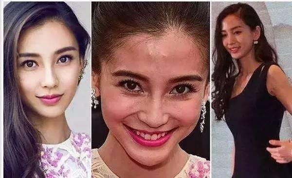 长痘消痘神器,长痘必备神器