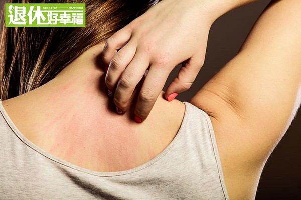 每天掉发很严重头皮屑多怎么办,每天掉发头皮屑