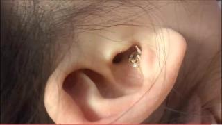 怎样才能挖到这么大块耳屎?恶心!但看着好爽啊!