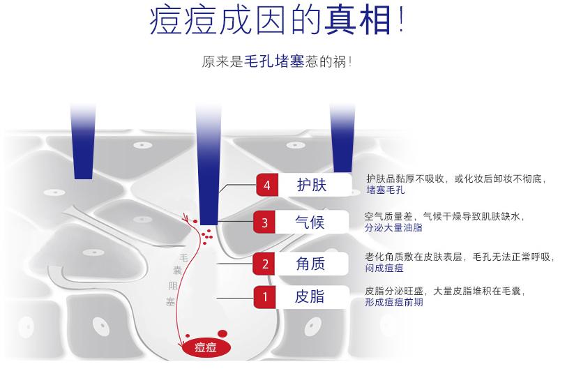 唯恩诗对敏感肌肤有效吗,唯恩诗柔肤乳