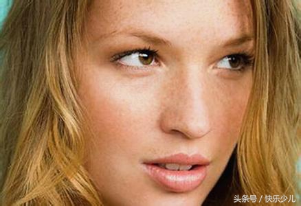 蝴蝶斑并非孕妇的特质，如何很好的有效预防