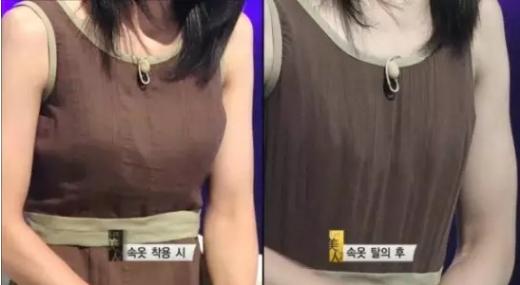 韩国整容手术恢复过程,韩国一个整容的综艺节目