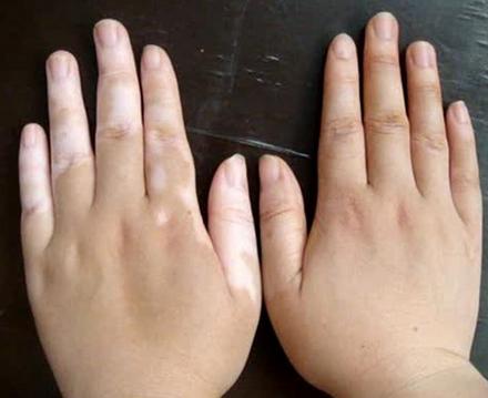 什么纹身遮盖膏可以遮住,肉色纹身遮盖白斑效果图