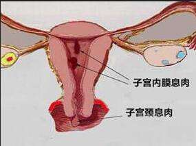 月经过多是什么疾病,月经量突然增多要小心五种病