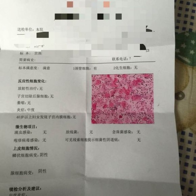 月经推迟是大病的前兆吗,月经推迟有可能是什么病