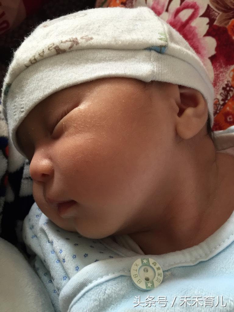 歪颈宝宝如何纠正,宝宝因为习惯导致的斜颈怎么纠正