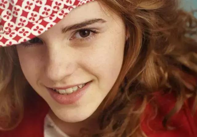 色斑暗沉没有光泽,遮不掉的黑眼圈祛不掉的痘印