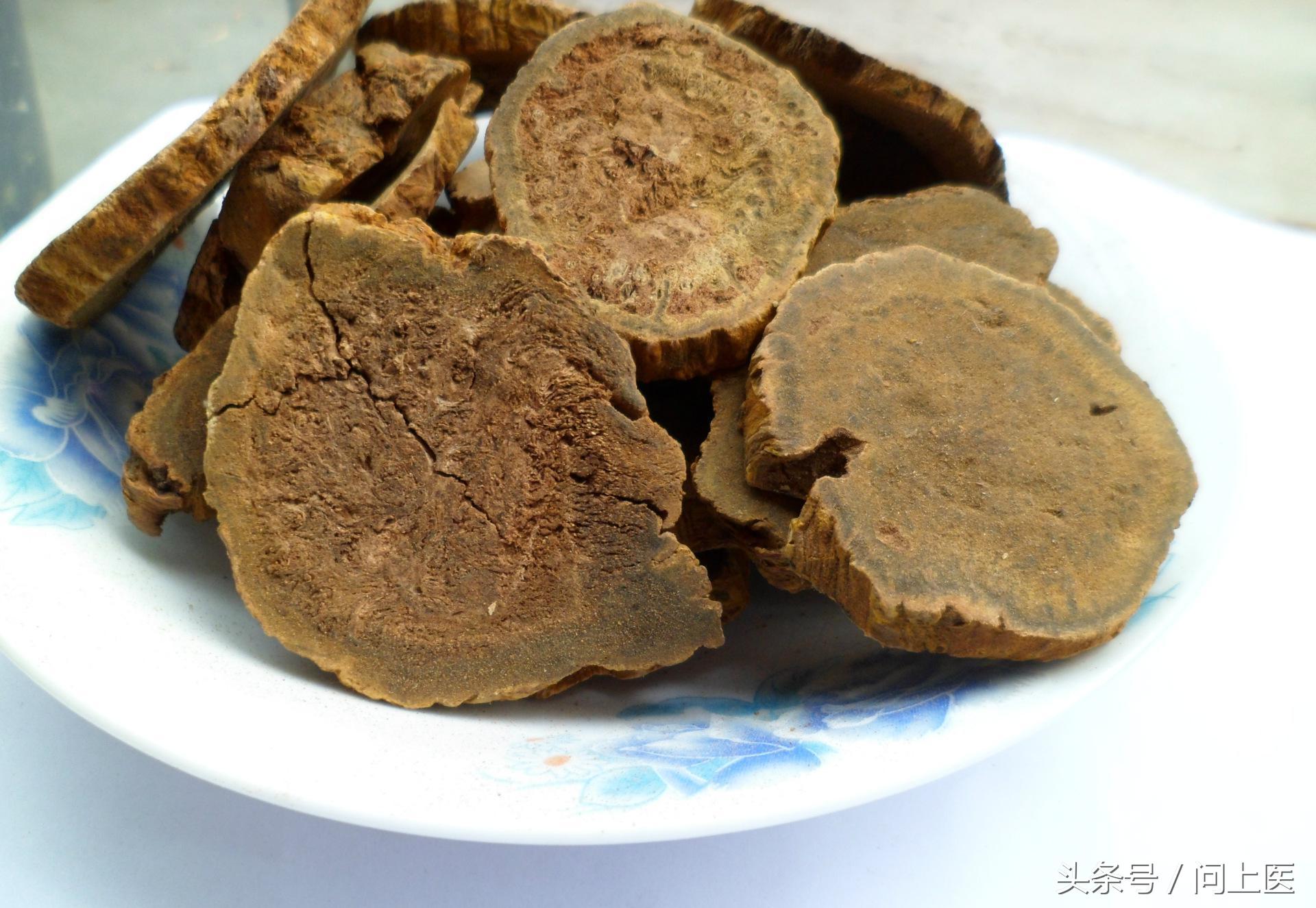 教你看懂尿检单,尿检常识100例