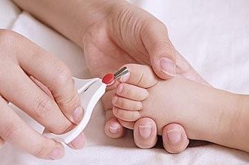 新生宝宝尿尿带血怎么办,宝宝尿血但是精神好