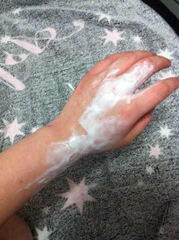 受伤的鱼怎么钓最好,钓到的鱼怎么抓不扎手