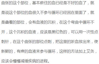 精索静脉曲张艾灸灸哪个穴位,静脉曲张可以艾灸足三里吗