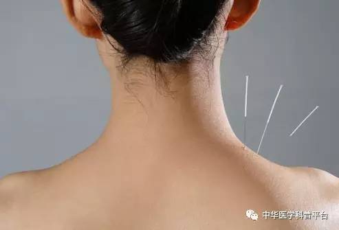 有什么办法治疗紧张性头痛,中医治疗紧张性头痛的方法