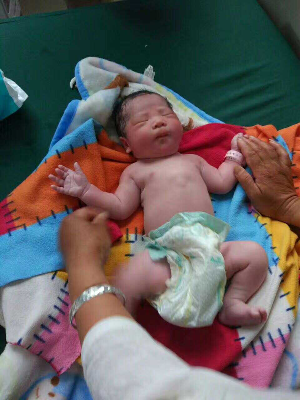 剖腹产的时候宝宝胎动怎么办,胎动频繁剖腹产