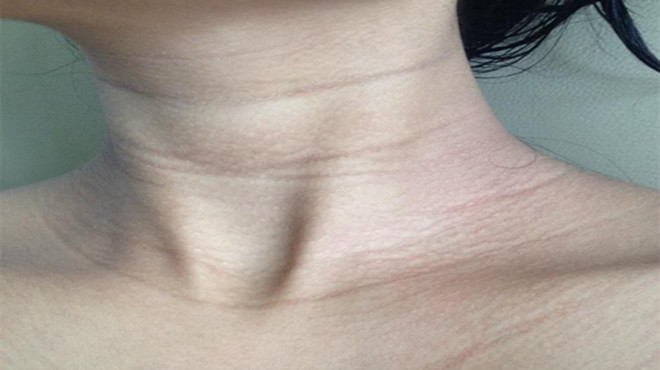 睡觉要什么枕头才能预防皱纹,睡什么样的枕头减少脸部皱纹