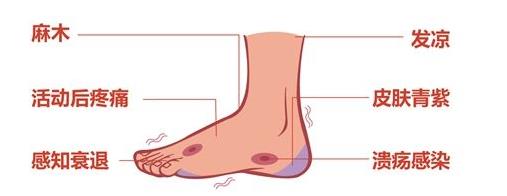 糖尿病不可怕并发症可怕视频,糖尿病综合症和糖尿病并发症