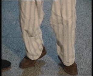 吃什么食物可以预防心脑血管堵塞,十大现象预示血管已堵塞