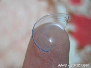 吓死本宝宝了，隐形眼镜操作不当造成*血丝红**