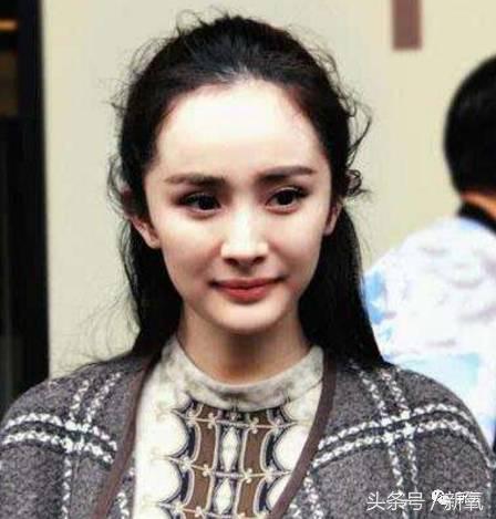 杨幂发际线还会回归吗,杨幂发际线秃到后脑勺