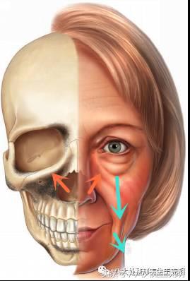 杨紫的法令纹能消除吗,杨紫法令纹很深怎么回事