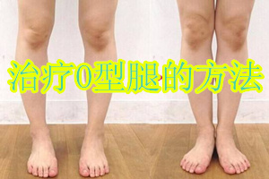 草本贴真的能治疗o型腿吗,青少年o型腿怎么治疗