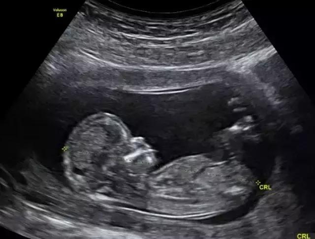 澳洲发明十大神器,澳洲十大发明