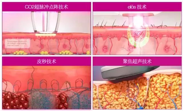 中国市场地位,赛龙诺