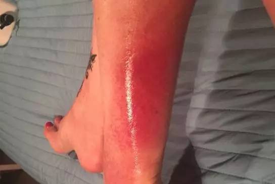 去西北旅游防晒乳推荐哪款好,进藏防晒有用吗