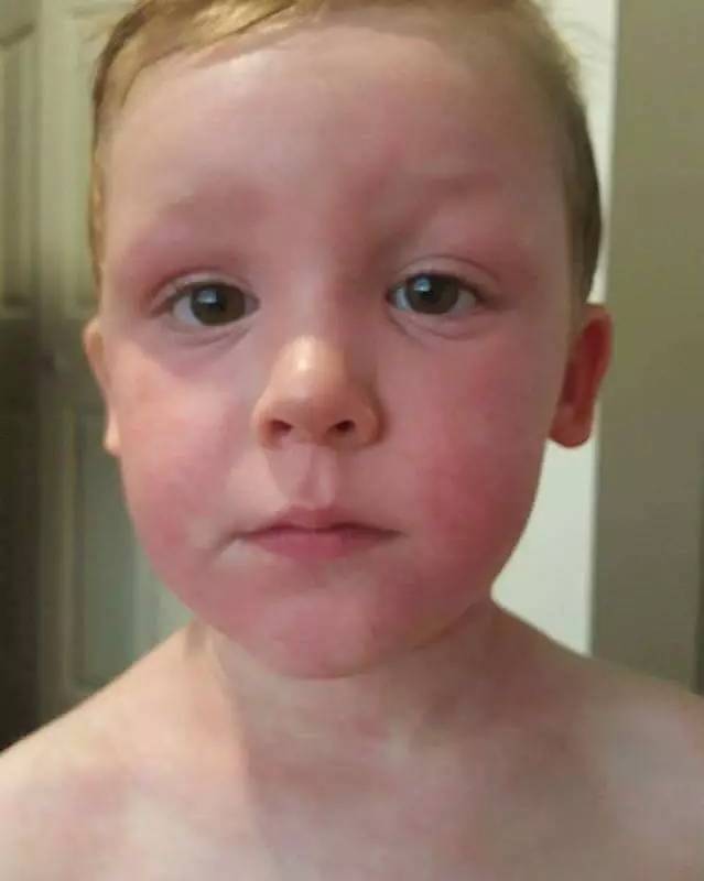 去西北旅游防晒乳推荐哪款好,进藏防晒有用吗