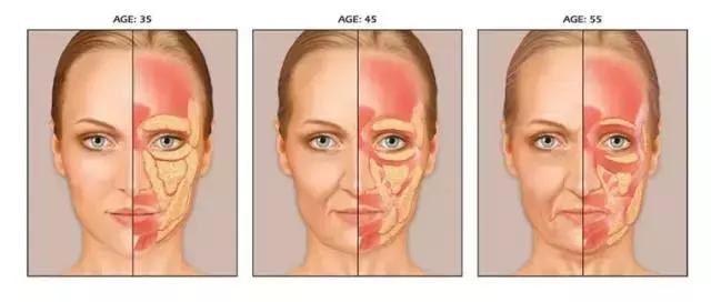 最靠谱的除皱产品,什么除皱效果好又平价